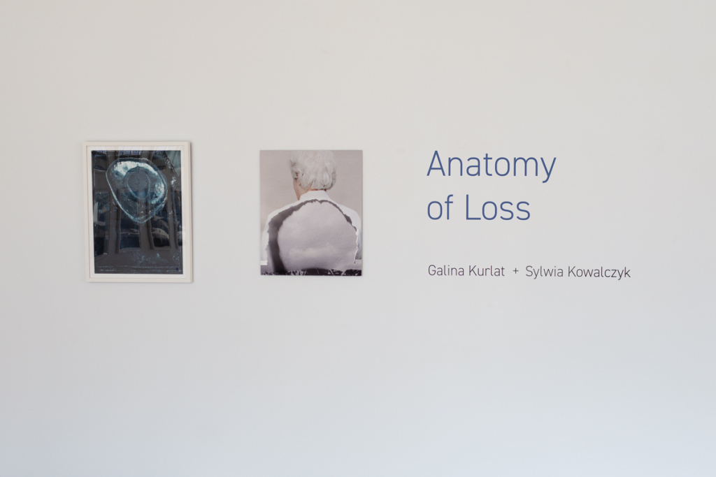 Anatomyof Loss Install02